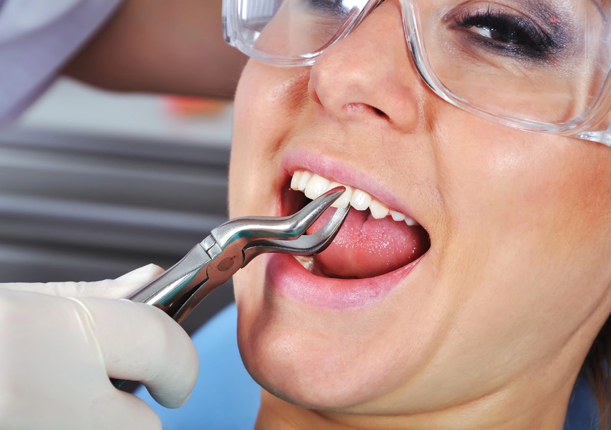 Painless Wisdom Teeth Removal in Burley ID